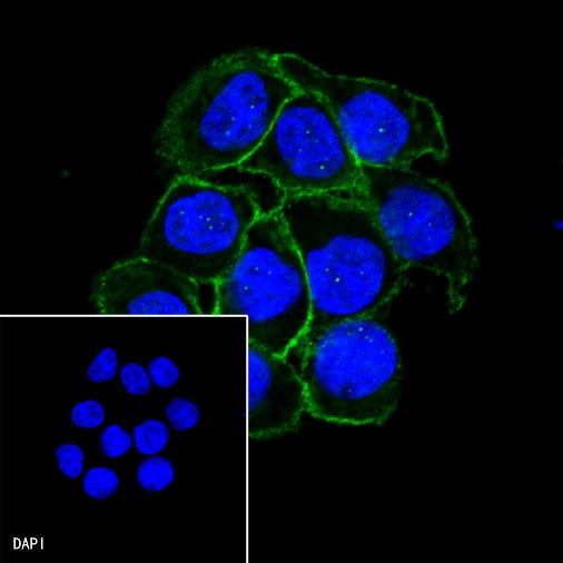 E-Cadherin Recombinant Rabbit mAb (SDT-438-45)
