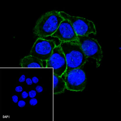 E-Cadherin Recombinant Rabbit mAb (SDT-438-45)