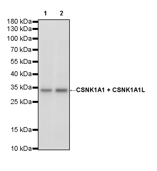 CSNK1A1 + CSNK1A1L Recombinant Rabbit mAb (S-4407-18)