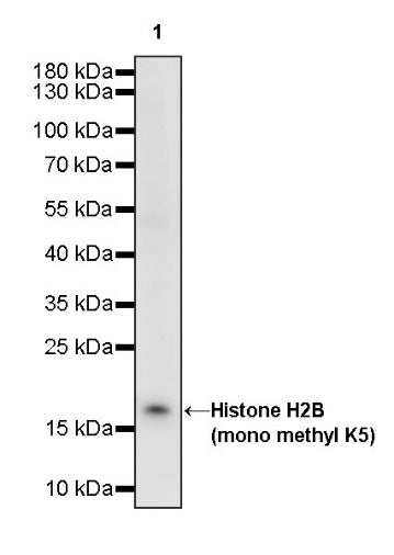 Histone H2B (mono methyl K5) Recombinant Rabbit mAb (S-1416-412)
