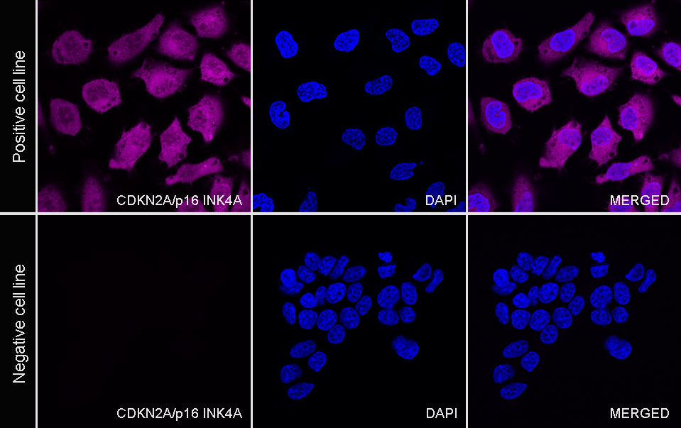 CDKN2A/p16 INK4A Recombinant Mouse mAb (Alexa Fluor® 647 Conjugate) (SDT-4675)