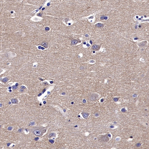 TrkB Recombinant Rabbit mAb (S-488-5)
