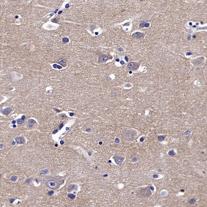 TrkB Recombinant Rabbit mAb (S-488-5)
