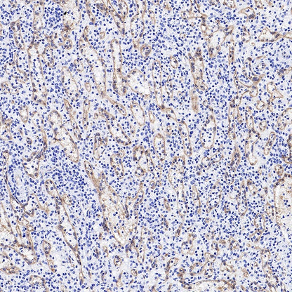 eNOS Recombinant Rabbit mAb (S-1885-94)
