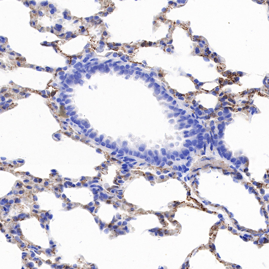 CD146 Recombinant Rabbit mAb (SDT-348-6)