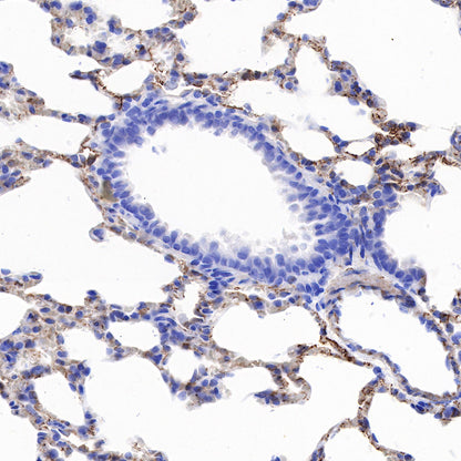 CD146 Recombinant Rabbit mAb (SDT-348-6)