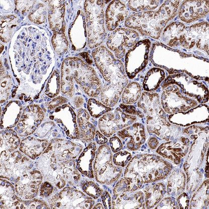 Parkin Rabbit Polyclonal Antibody