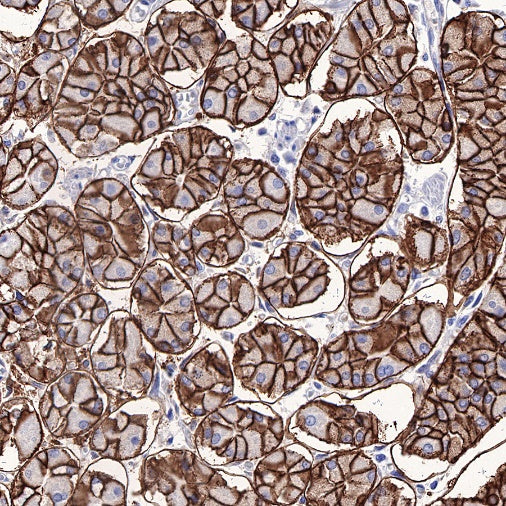 Carbonic Anhydrase 9 Recombinant Rabbit mAb (SDT-733-28)