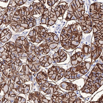Carbonic Anhydrase 9 Recombinant Rabbit mAb (SDT-733-28)