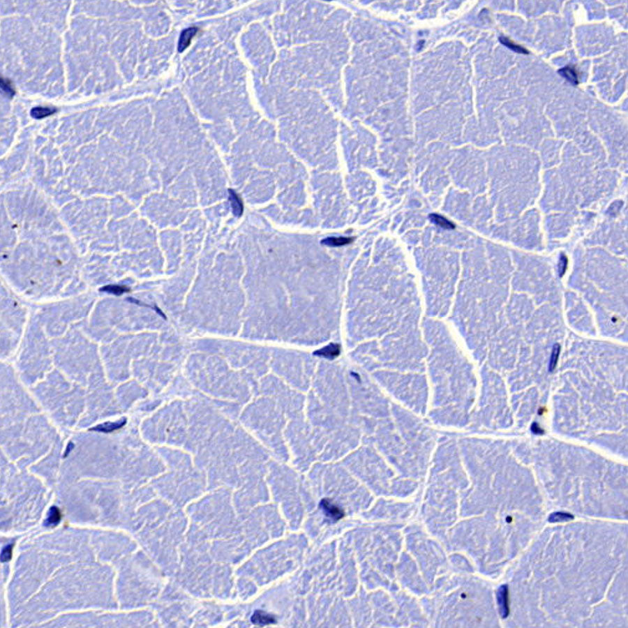 GLUT3 + GLUT14 Recombinant Rabbit mAb (S-5945)