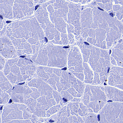 GLUT3 + GLUT14 Recombinant Rabbit mAb (S-5945)