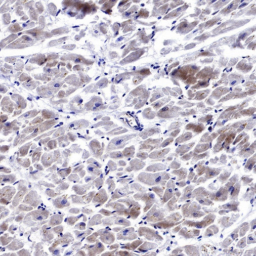 GABARAP Recombinant Rabbit mAb (S-2372-47)