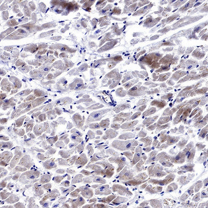 GABARAP Recombinant Rabbit mAb (S-2372-47)