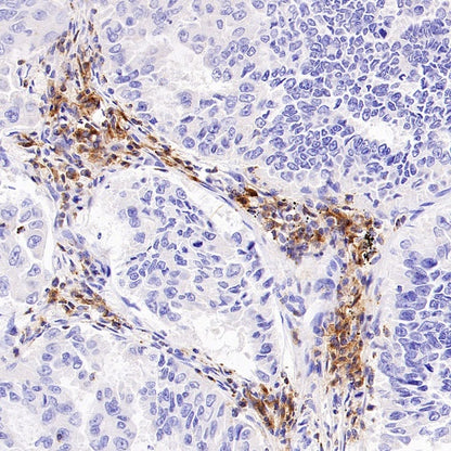 LY9/CD229 Recombinant Rabbit mAb, PBS Only (SDT-2393-47)