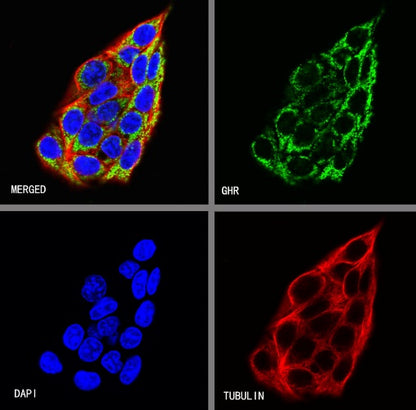 GHR Recombinant Rabbit mAb (S-1320-123)