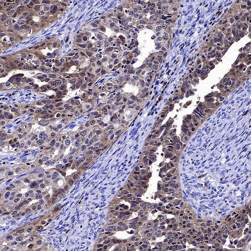 PKC delta Recombinant Rabbit mAb (S-2611-39)