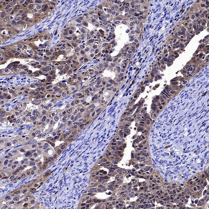 PKC delta Recombinant Rabbit mAb (S-2611-39)