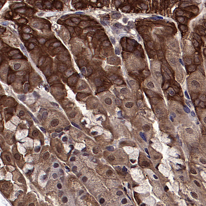 HSP90 Recombinant Rabbit mAb (S-5412)