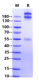 PAPP-A His Tag Protein, Human