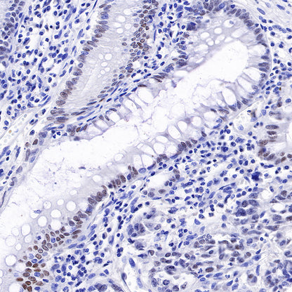 HNF4α Recombinant Rabbit mAb (SDT-373-64)