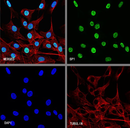 SP1 Recombinant Rabbit mAb (S-3073-71)