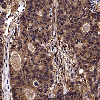 p38 delta/MAPK13 + p38 alpha/MAPK14 Recombinant Mouse mAb (S-3860)