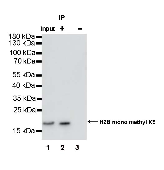Histone H3 (acetyl K18) Recombinant Rabbit mAb (S-1688-90)