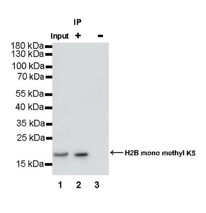 Histone H3 (acetyl K18) Recombinant Rabbit mAb (S-1688-90)
