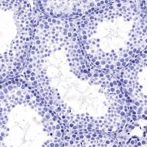 Cyclin E1 Recombinant Rabbit mAb (SDT-2512-182)