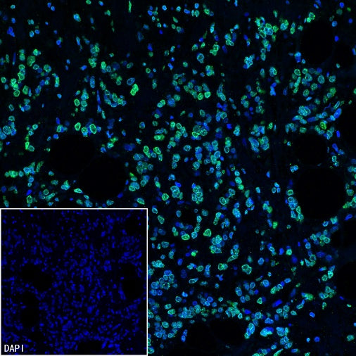 Histone H3 (tri methyl K9) Recombinant Rabbit mAb (S-3826)