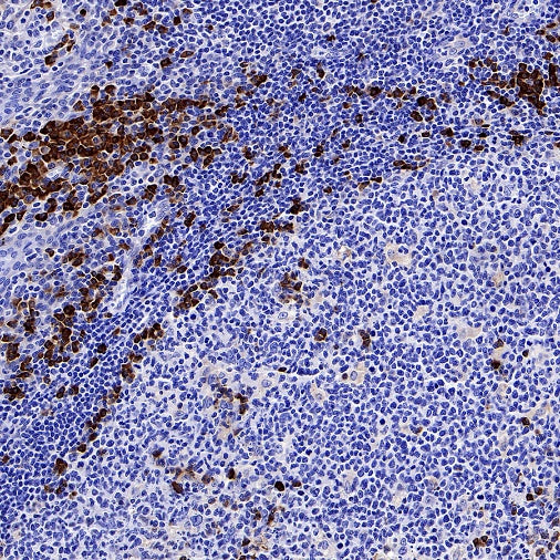 CXCR3 Recombinant Rabbit mAb (S-377-8)