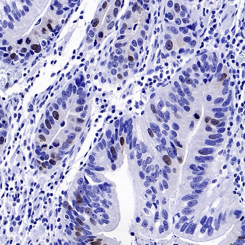 Survivin Recombinant Rabbit mAb (S-2334-26)