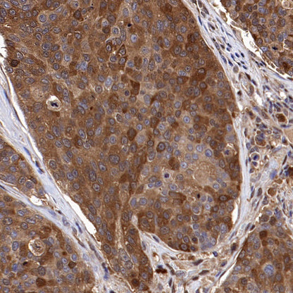 L-Lactate Dehydrogenase A/LDHA Rabbit Polyclonal Antibody