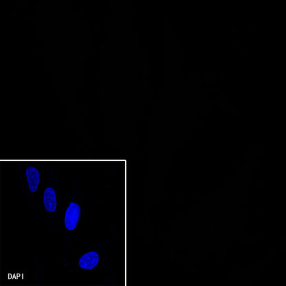 FOXA2 Recombinant Rabbit mAb (SDT-R174)