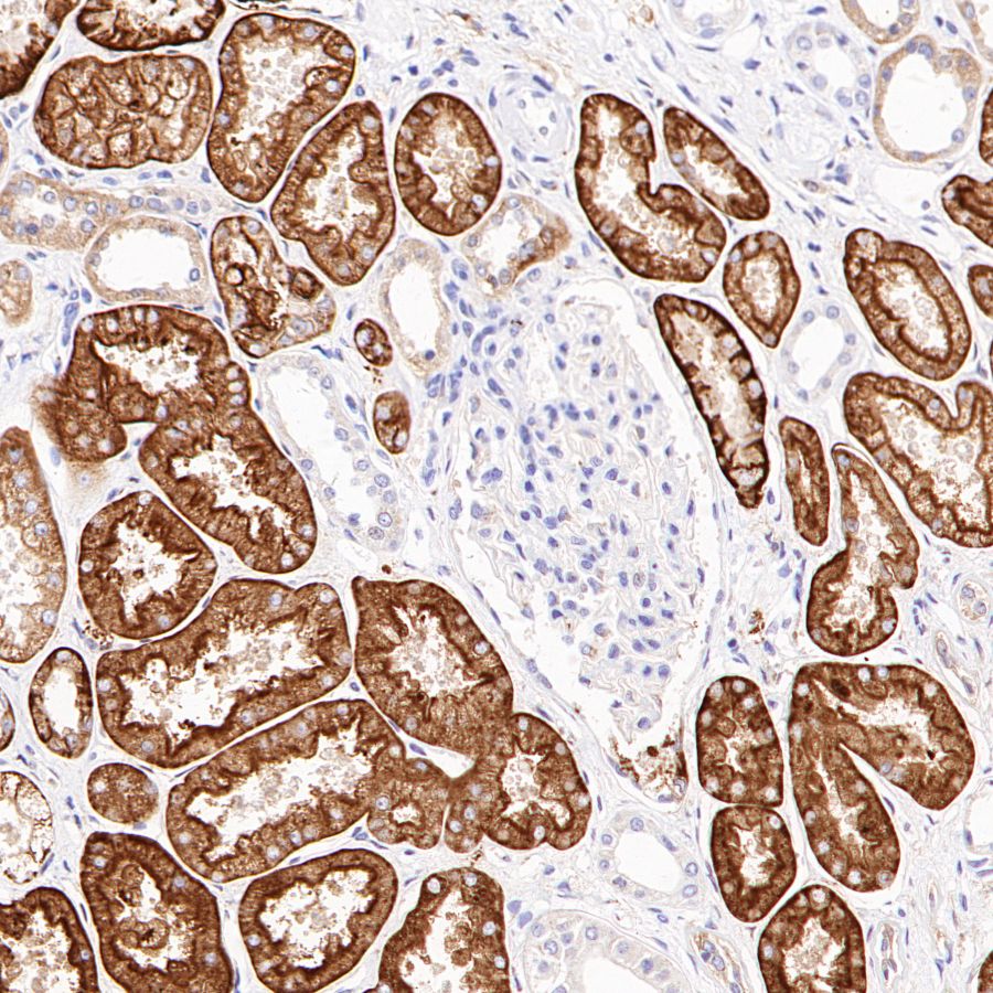 CD98/SLC3A2 Recombinant Rabbit mAb (SDT-2038-19)