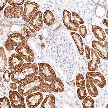 CD98/SLC3A2 Recombinant Rabbit mAb (SDT-2038-19)
