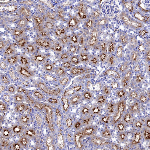 ENPP3/CD203c Recombinant Rabbit mAb (S-1632-11)