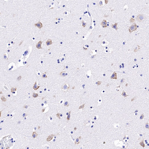UGGT1 Recombinant Rabbit mAb (S-1079-19)
