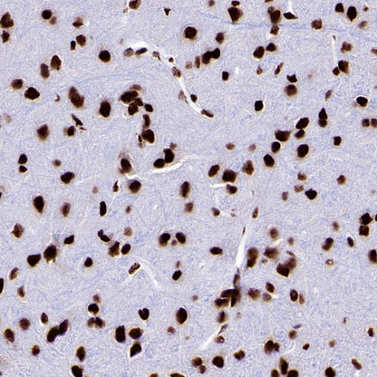 ARID1A Recombinant Rabbit mAb (S-440-62)