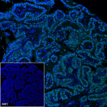 PAX8 Recombinant Rabbit mAb (SDT-R509)