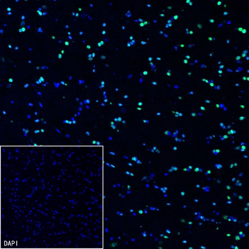 DLX5 Recombinant Rabbit mAb (S-2785-79)