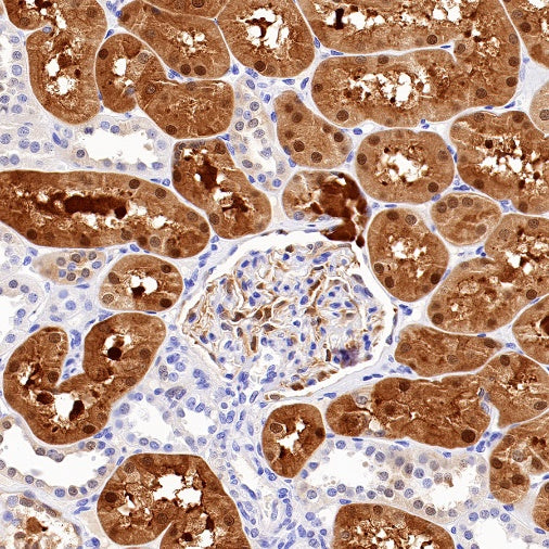 QPRT Recombinant Rabbit mAb (S-1228-31)