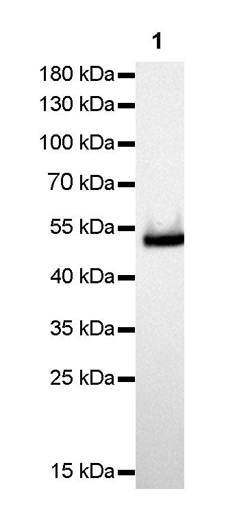 Keratin 14 Recombinant Rabbit mAb(SDT-023-1)