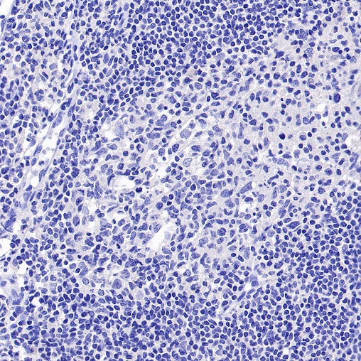 ROR1 Recombinant Rabbit mAb (SDT-R502-2)