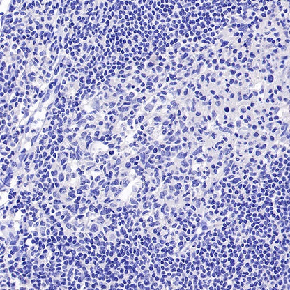 ROR1 Recombinant Rabbit mAb (SDT-R502-2)