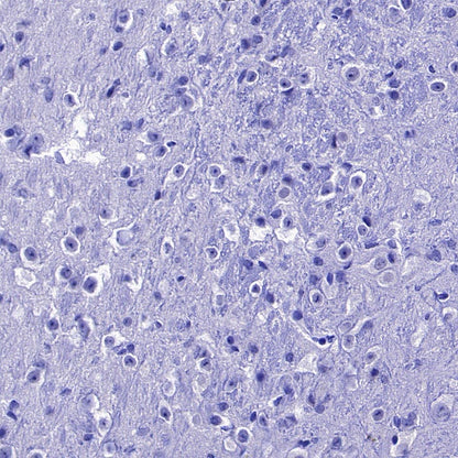 Coagulation factor V Recombinant Rabbit mAb (S-4489-58)