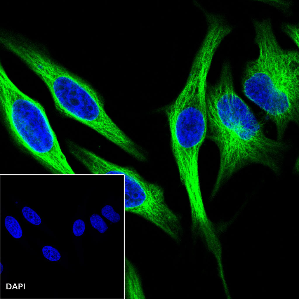 β-tubulin Recombinant Rabbit mAb (SDT-R014)