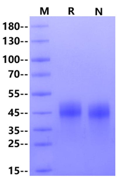 CLEC5A His Tag Protein, Cynomolgus