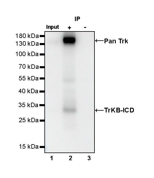 S-RMab® Pan Trk Recombinant Rabbit mAb (SDT-512-5)