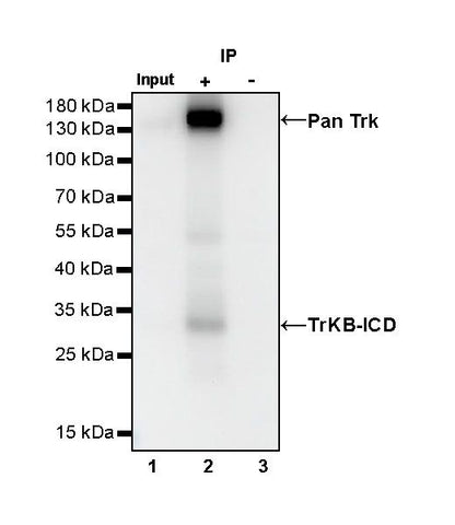 S-RMab® Pan Trk Recombinant Rabbit mAb (SDT-512-5)